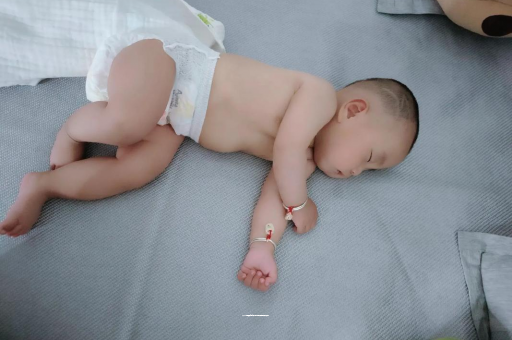 武汉供卵包生男孩宝宝头上长痱子